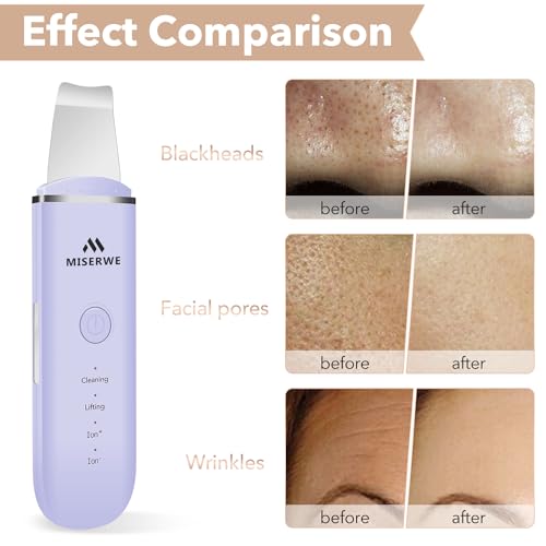 Skin Scrubber Face Skin Spatula Facial Scrubber Spatula for Deep Cleansing Blackhead Remover Pore Cleaner with 4 Modes (Purple) - color: Purple