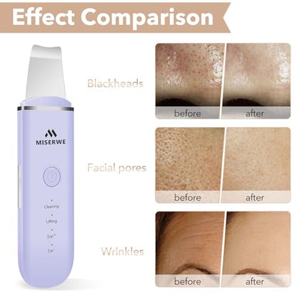 Skin Scrubber Face Skin Spatula Facial Scrubber Spatula for Deep Cleansing Blackhead Remover Pore Cleaner with 4 Modes (Purple) - color: Purple