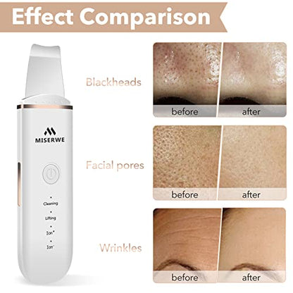 Skin Scrubber Face Skin Spatula Facial Scrubber Spatula for Deep Cleansing Blackhead Remover Pore Cleaner with 4 Modes (White) - color: White