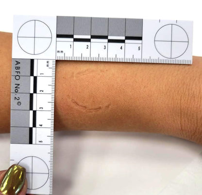 Crime Scene Photomacrographic Scale (No.2-Metric) - size: 1 m